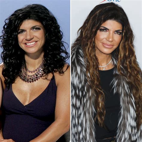 teresa giudice boobs|Real Housewives Plastic Surgery: Before and After。